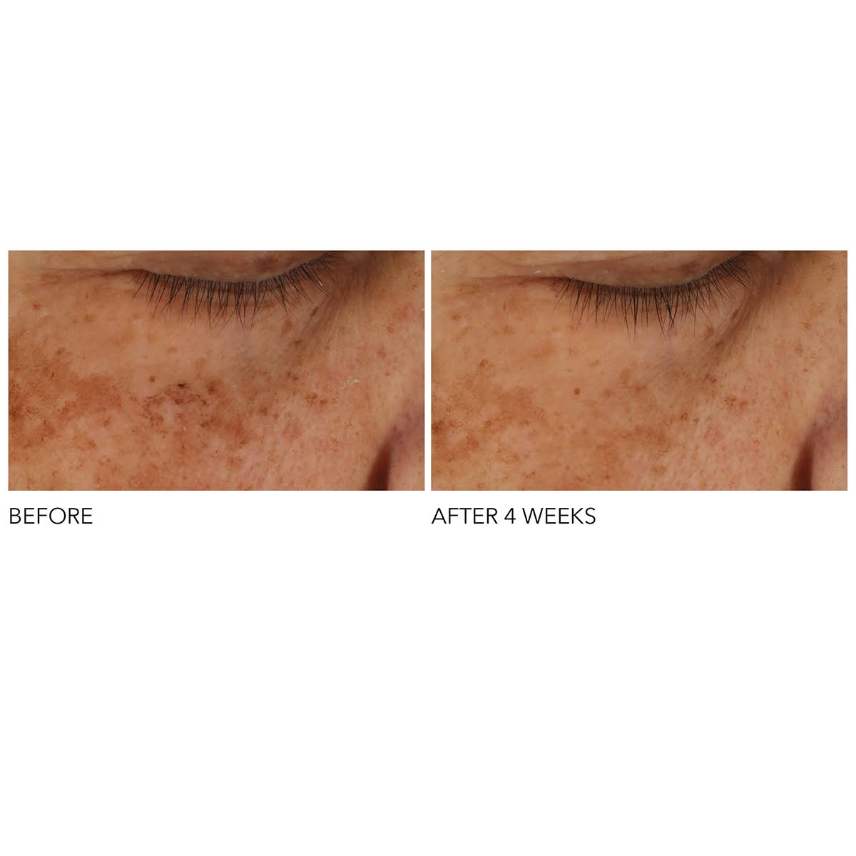 Advanced Retinol + Ferulic Overnight Peel K37531
