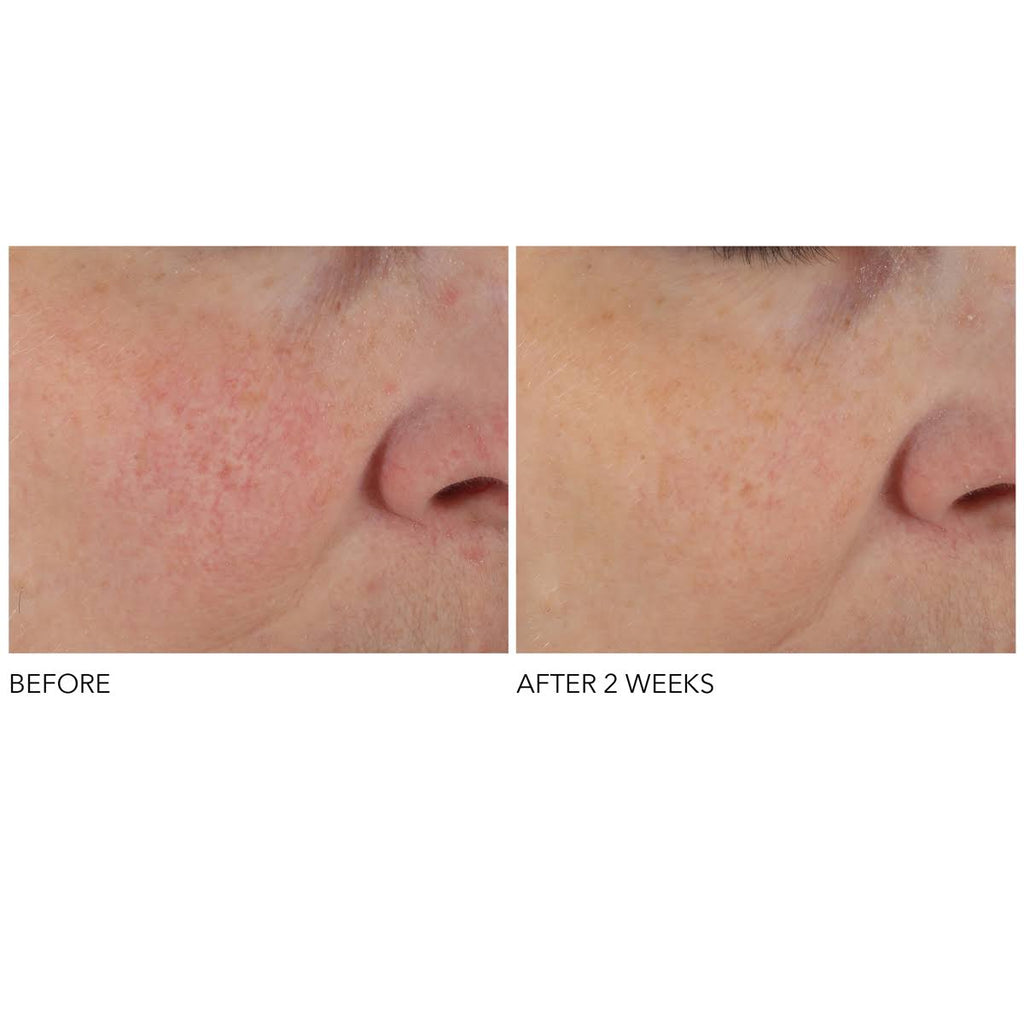 Advanced Retinol + Ferulic Overnight Peel K37531