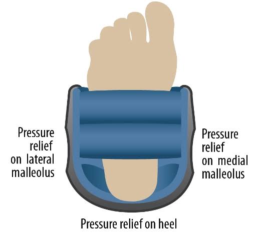 Heel and Ankle Protector F276753